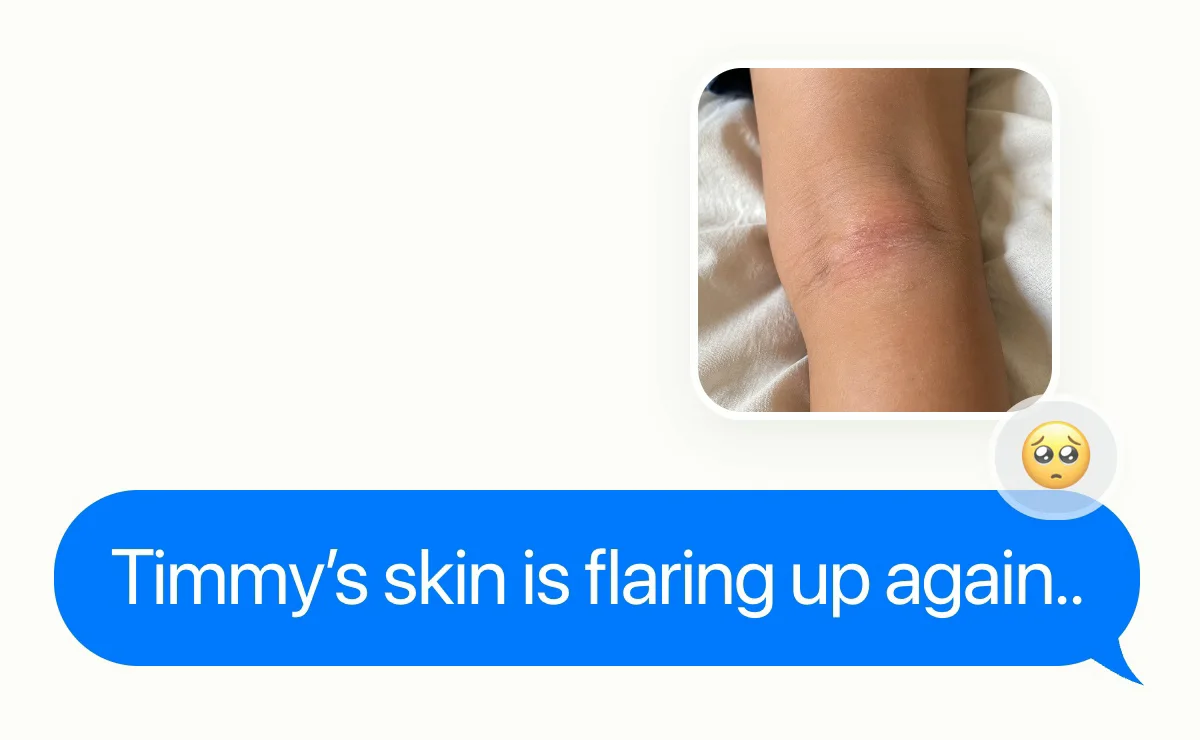 A message with a photo of a child's arm and the words: Timmy's skin is flaring up again.